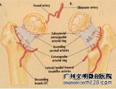 带血管蒂骨瓣移植术