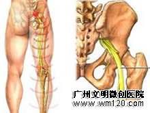 弱精应该怎么治疗？